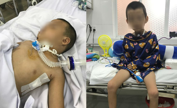 Bác sĩ chia sẻ hành trình giành lại sự sống cho bé trai 5 tuổi té ngã gần đứt lìa cổ họng