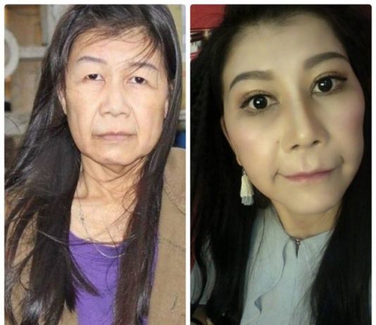 Cô gái 9X sống trong thân hình cụ bà 80