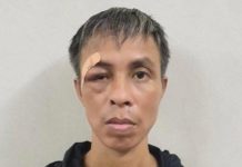 Buồn chán phải chữa bệnh, vô cớ đ.â.m trọng thương bệnh nhân cùng phòng