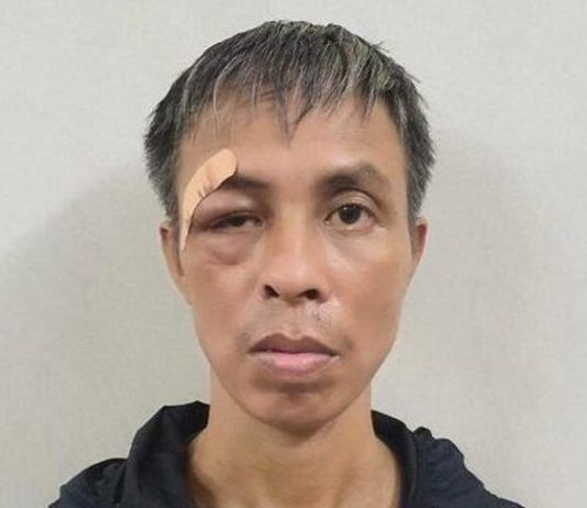 Buồn chán phải chữa bệnh, vô cớ đ.â.m trọng thương bệnh nhân cùng phòng