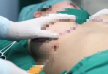 Diễn biến mới vụ chở th.i th.ể từ TP HCM về Trà Vinh, khai t.ử v.o.ng khi nâng ngực