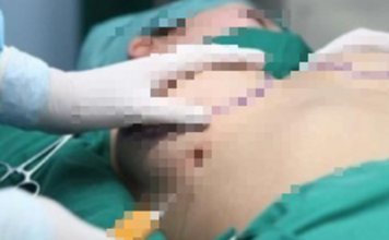 Diễn biến mới vụ chở th.i th.ể từ TP HCM về Trà Vinh, khai t.ử v.o.ng khi nâng ngực