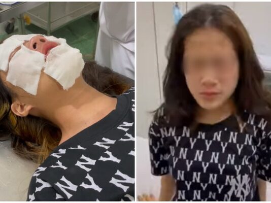 Hải Phòng: Chọc ghẹo không thành, nam thanh niên cay cú hành hung, xịt hơi cay vào mặt nữ sinh rồi bỏ đi