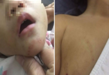 Hải Phòng: Bé gái 16 tháng tuổi nghi bị bạo hành với nhiều vết thương trên cơ thể, công an vào cuộc xác minh