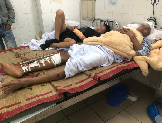 Đi xuồng máy, dùng dao kiếm đ.âm ché.m tới tấp, tr.uy sát 3 ngư dân