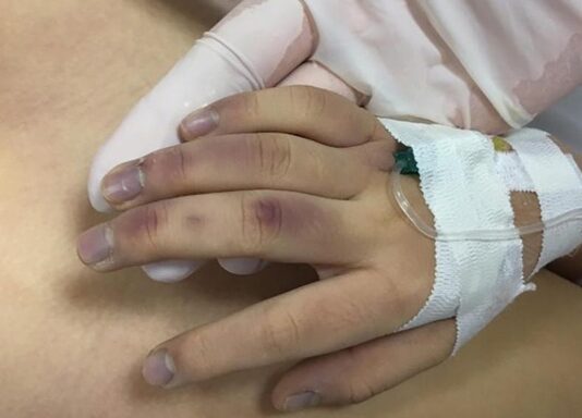 Bố đ.ánh con gái 6 tuổi tuổi t.ử v.o.ng