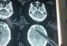 Vụ người dân tố bị đ.ánh chấn thư.ơng sọ não: Có kết quả giám định ghi âm