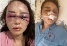 NÓNG: Bắt cán bộ QLTT đ.ánh bạn gái dã man vì hát song ca với người khác