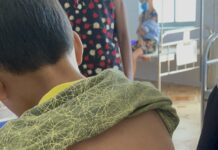 Một cháu bé 9 tuổi ở Quảng Bình bị người thân dùng xăng và rơm đốt