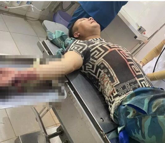 Gã đàn ông “bắt sâu” trên ngực vợ hàng xóm, chém chồng trọng thương