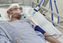 Nam sinh lớp 8 bị đ.ánh chấn thương sọ não khi chơi bóng rổ