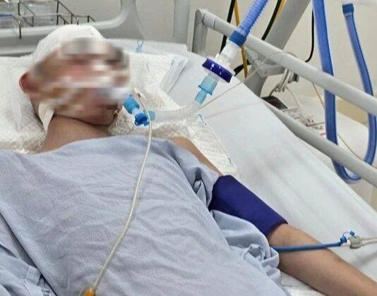 Nam sinh lớp 8 bị đ.ánh chấn thương sọ não khi chơi bóng rổ