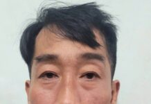 Bị bạn nhậu đốt ch.ế.t vì ném bỏ “mồi” là đầu cá